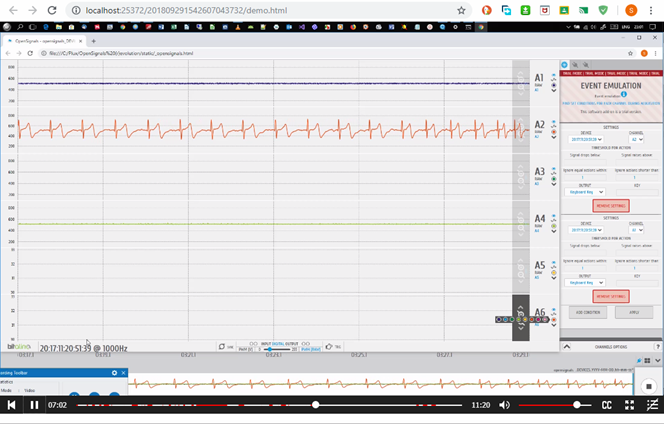 ECG bitalino
