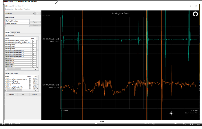 EEG bitalino